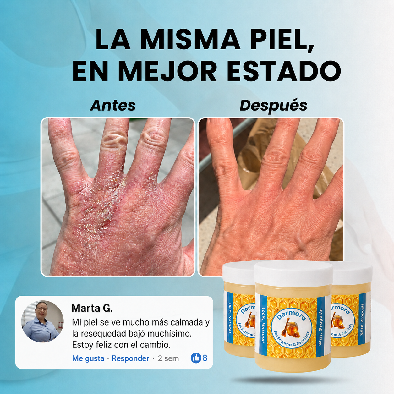 Dermora™ Balsamo reparador